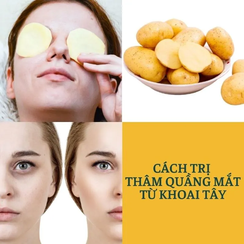 Bật mí 5 loại mặt nạ trị thâm mắt từ nguyên liệu tự nhiên