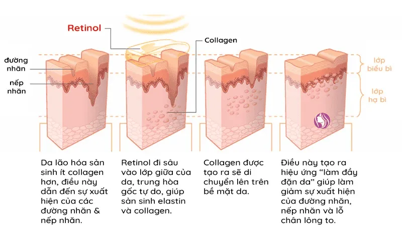 Retinoid là gì? Nên hay không nên sử dụng?